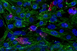 CELLINK BIONOVA X：人类微心脏模型助力精准医疗与药物研发