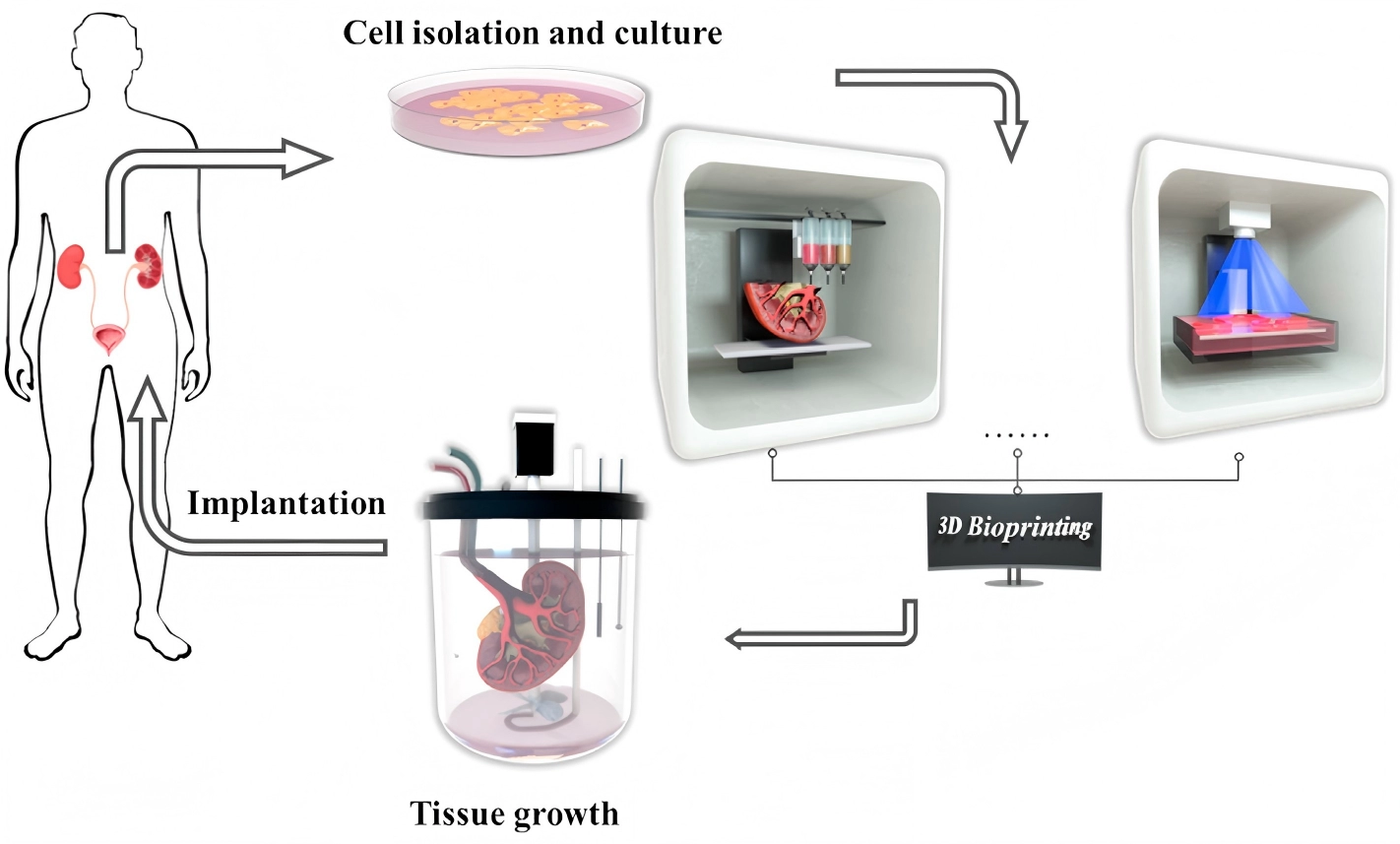 3D生物打印为泌尿疾病治疗打开新赛道
