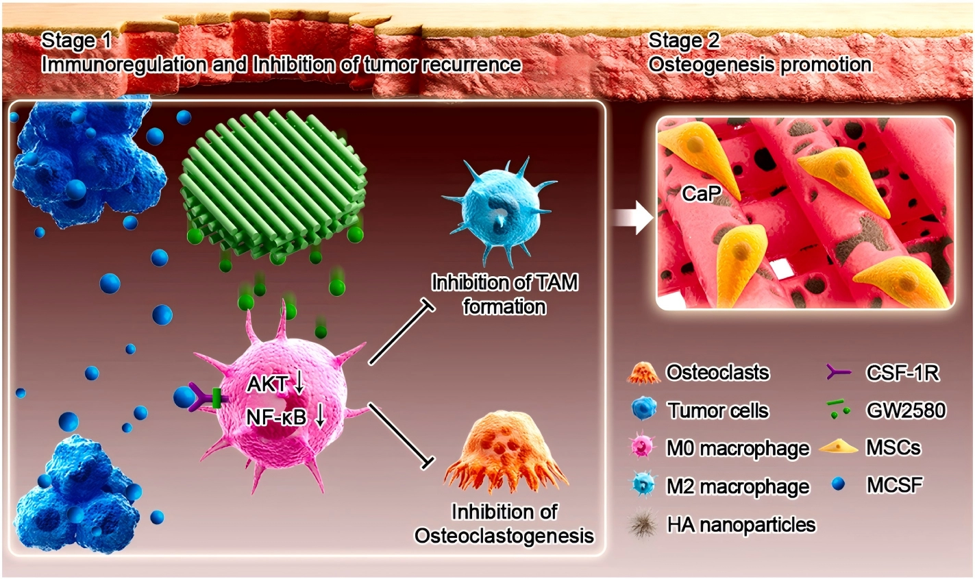 生物3D打印支架：骨肿瘤术后康复新路径