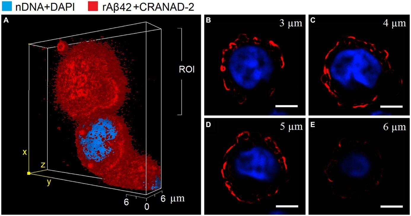 OLS CERO 3D体系，支撑阿尔茨海默病与 HHT2 前沿探索